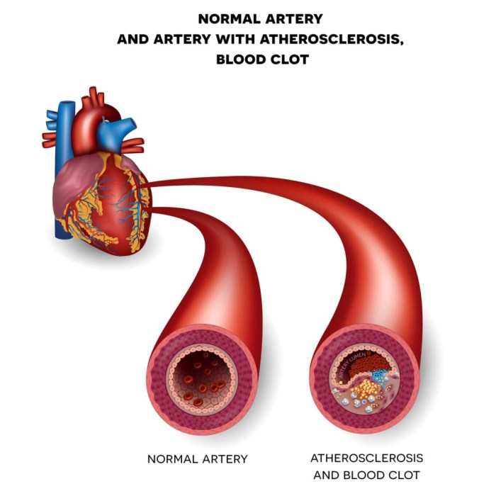 Capillary tubes